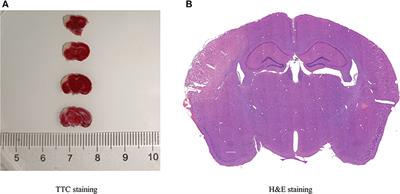 The Alteration Profiles of m6A-Tagged circRNAs in the Peri-Infarct Cortex After Cerebral Ischemia in Mice